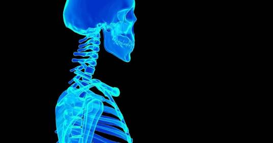 Sindrome della ‘testa che scivola sul collo’, come riconoscerla e trattarla