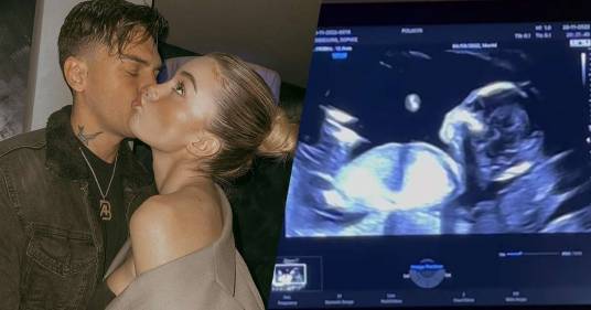 Sophie Codegoni e Alessandro Basciano diventeranno genitori: ecco l’annuncio su Instagram