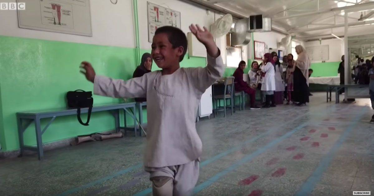 Il bambino afghano torna a ballare grazie alla protesi il video