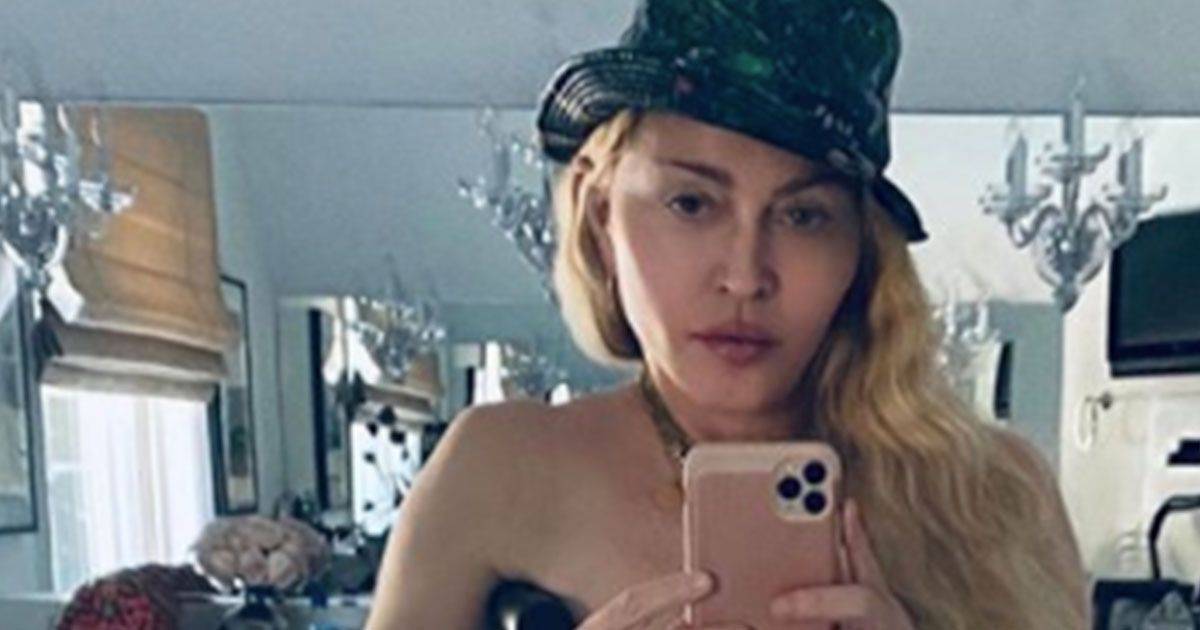 Madonna in topless e stampella lultima provocazione della diva